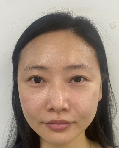 はじめの日の写真。白い壁の前で、素顔の女性が正面を向いている