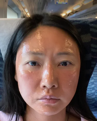 反応が出た日の写真。顔に製品がのってつやがあり、頬に赤みがある